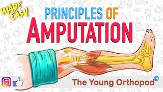 Amputation Principles | ANIMATION | BASICS | NEET PG | Amputee - The Young Orthopod
