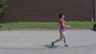 Hop-Skip Running - Above Knee Amputee (C-Leg)