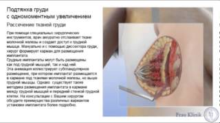 Подтяжка груди (мастопексия) с увеличением - Размещение имплантата