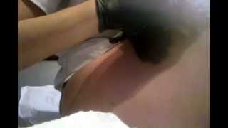 Sugaring Hair Removal Technique for the Back of Your Thigh - Vadazzle.com
