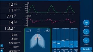 How does a ventilator works