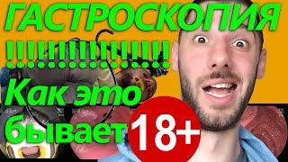 ГАСТРОСКОПИЯ или ЭГДС. Как проходит, как бывает.