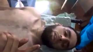 Украина АТО. Раненый Чеченец на операционном сто