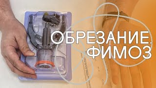 Обрезание крайней плоти. Фимоз