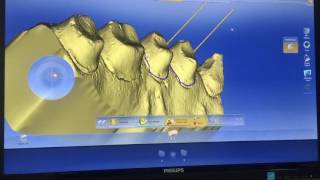 Cerec Redcam 64bit working with inLab 4.2.5 and Exocad 2015