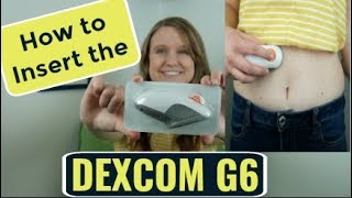 Dexcom G6 Sensor Insertion Tutorial! (Continuous Glucose Monitor)