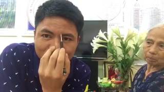 Diện Chẩn Việt   Hướng dẫn phục hồi sau nhổ răng, phác đồ chung    1 mp4