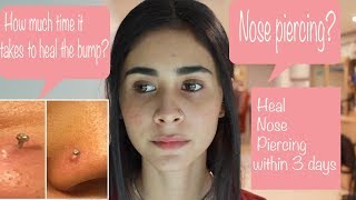 Nose Piercing Aftercare | Nose Pin or Nose Ring | Quick Heal