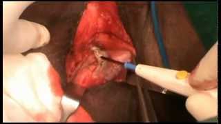 perineal urethrostomy