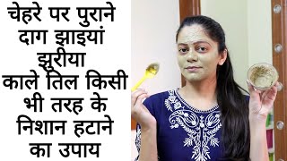 चेहरे पर सालों पुरानी झाइयां पिंपल एक्ने दाग तिल किसी तरह के निशान हटाने का ग्लो लाने का अचूक उपाय
