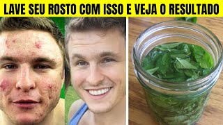 Receita Caseira de Chá de Hortelã Para Se Livrar das Espinhas Internas