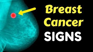 7 Early Signs Of Breast Cancer You Should Never Ignore !!