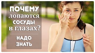 Почему лопаются сосуды в глазах?