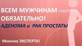 Аденома простаты (аденома предстательной железы, гиперплазия предстательной железы) [Галина Эриксон]