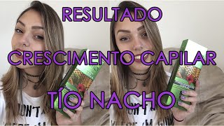 Resultado: TíO Nacho - Crescimento Capilar Acelerado
