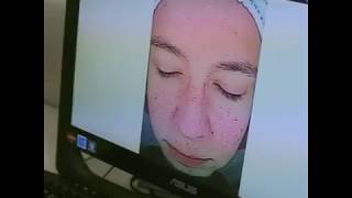 Диагностика состояния кожи. Клиника доктора Пенаева