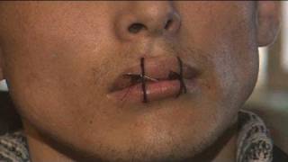 Kyrgyz inmates sew lips together in prison protest