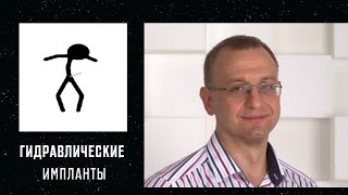 ПРОТЕЗИРОВАНИЕ. ГИДРАВЛИЧЕСКИЕ ИМПЛАНТЫ. Уролог, андролог, сексопатолог Алексей Корниенко.