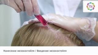 Фракционная мезотерапия кожи головы | Процедура Роял Медик