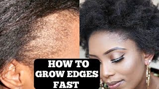 HOW TO GROW YOUR THIN/BALD EDGES IN 3 DAYS (GUARANTEED)