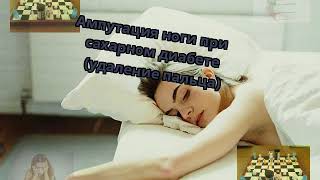 Ампутация ноги при сахарном диабете (удаление пальца)