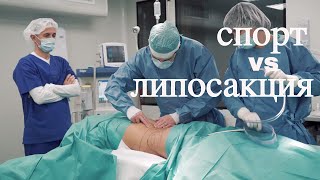 Липосакция // Как спасение от лишнего веса?