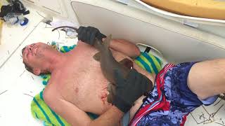 Nurse Shark BITES MAN