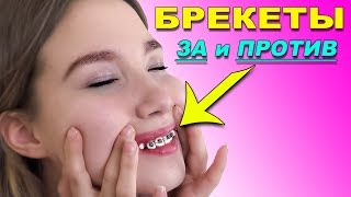 Как поставить БРЕКЕТЫ: Моя история Ожидание и реальность