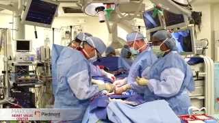Mitral Valve Repair for Anterior Leaflet Prolapse