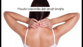 Ինչպես ազատվել պարանոցի վրայի կուզից
