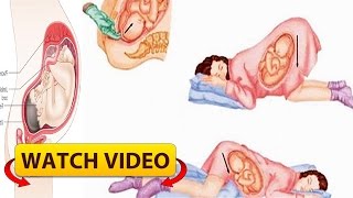 Proper Sleeping Position During Pregnancy You Must Know