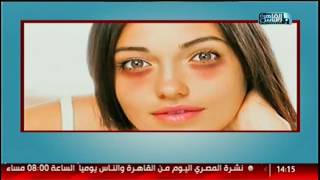 القاهرة والناس | فنيات الليزر الفحمى الكربوني لتجميل الوجه مع دكتور محمد منجى فى #الدكتور