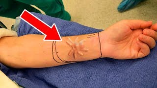 10 Самых Необычных Вещей, Найденных В Теле Человека