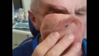 رجل يعيش بنصف وجه