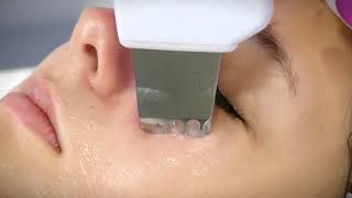 Ультразвуковой скрабер Zemits SonoPeel / Venko.com.ua
