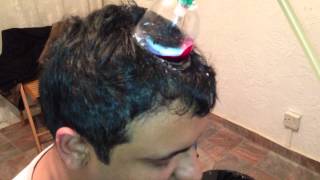 Cupping Lesson 3 الحجامه: Part 2/3 Cupping The Patience Head Without Shaving
