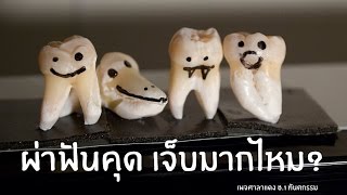 หลังผ่าฟันคุด เคล็ดลับที่ต้องฟัง