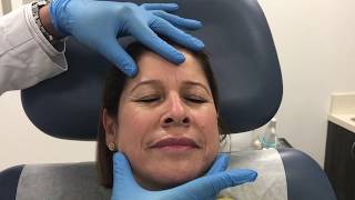 Facial rejuvenation using Sculptra, Restylane Refyne/Defyne, and Dysport by Dr. Patel