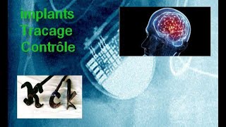 Ce samedi soir à 20h Synthèse implantés et reconnexion à notre mémoire, est-ce mal d'en parler?