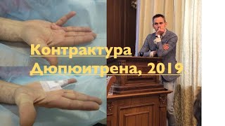 Лечение контрактуры Дюпюитрена. Что делать, если постепенно сгибаются пальцы?