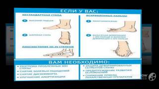 удобная накладка от вальгусной деформации

  - Valgus Pro - Обзор Фиксатора