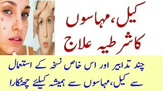 Keel Mahasay Ka ilaj
