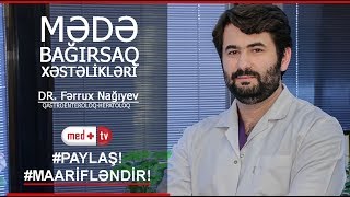 Mede bagirsaq xestelikleri -Dr Ferrux Nagiyev Qastroenteroloq Hepatoloq Oksigen Klinikasi Medplus TV