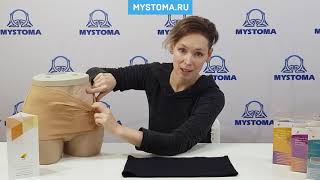 Универсальные пояса для стомированных. Видеообзор от бренда IRII.