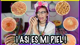 ASÍ SE VE TU PIEL BAJO UN MICROSCOPIO!! ?NO LO VAS A CREER - Lulu99