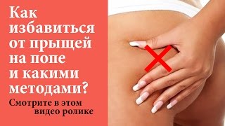 Прыщи на попе ➢ 5 ЭФФЕКТИВНЫХ методов от них избавиться! Смотрите в этом видео