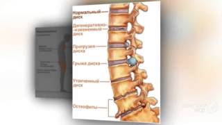 денситометрия позвоночника