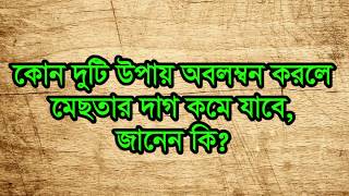 How to Remove Blackheads at Home | মেছতার দাগ দূর করার সহজ উপায়