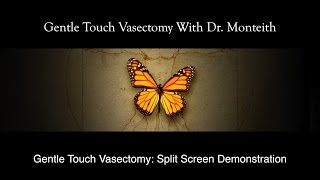Gentle Touch Vasectomy | Real vasectomy demonstration
