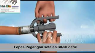 Sunat Stapler  RYPS